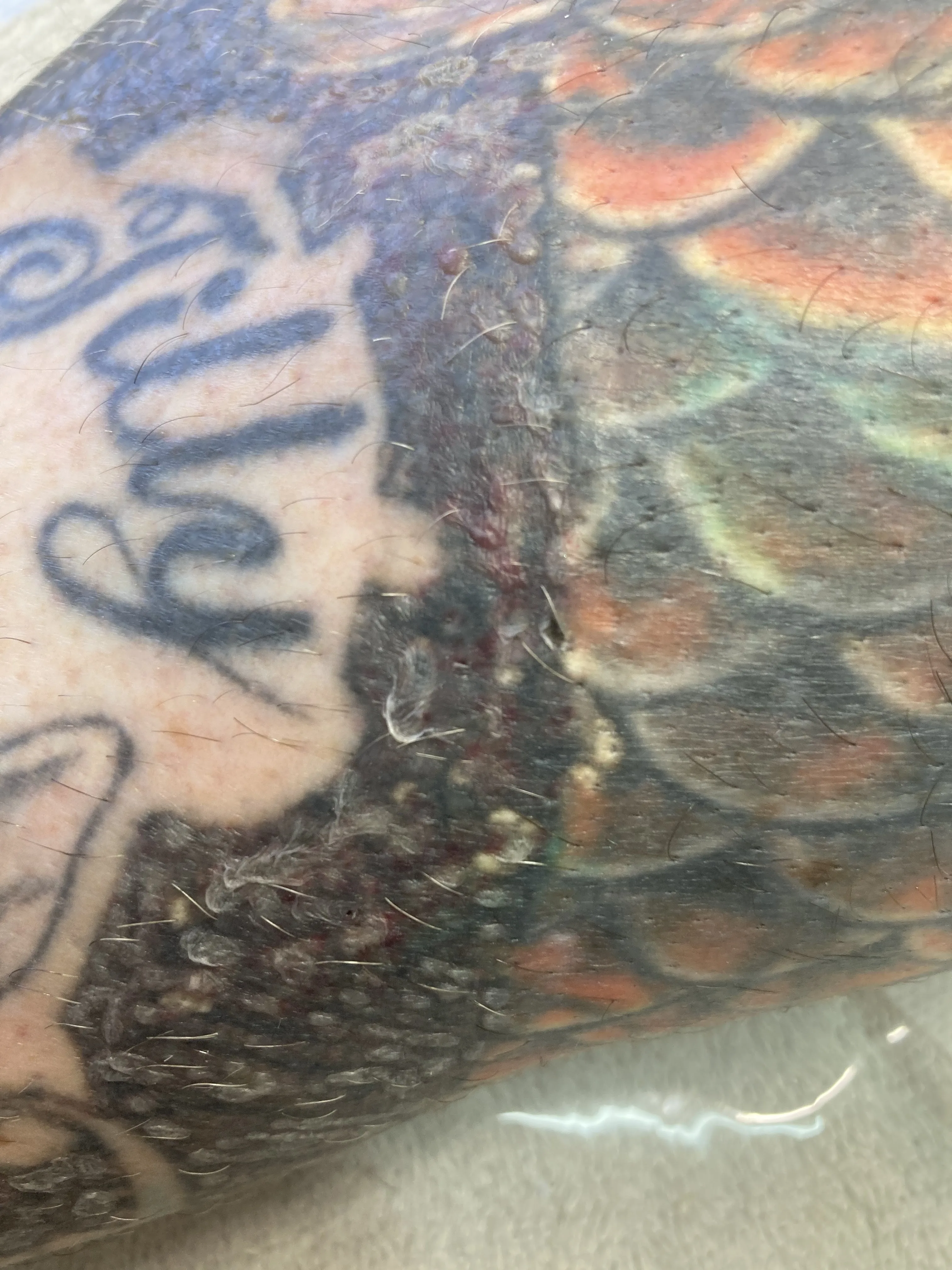 A single laser pass across tattooed skin — the treated band gone pale and frosted while the ink either side is untouched