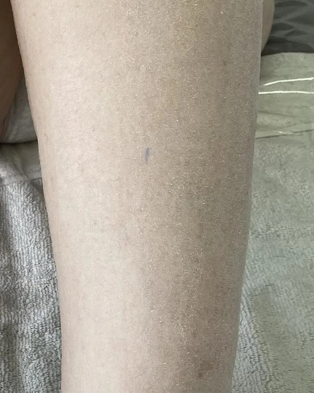 A bare lower leg on a towel after waxing — skin smooth and clear